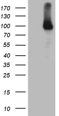 RRM1 Antibody