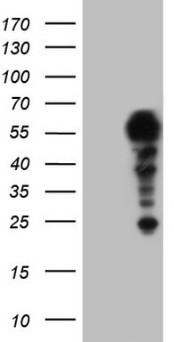 SETD2 Antibody
