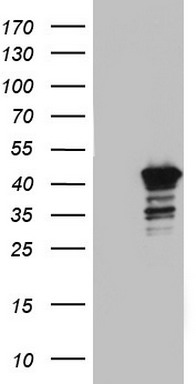 BFSP2 Antibody