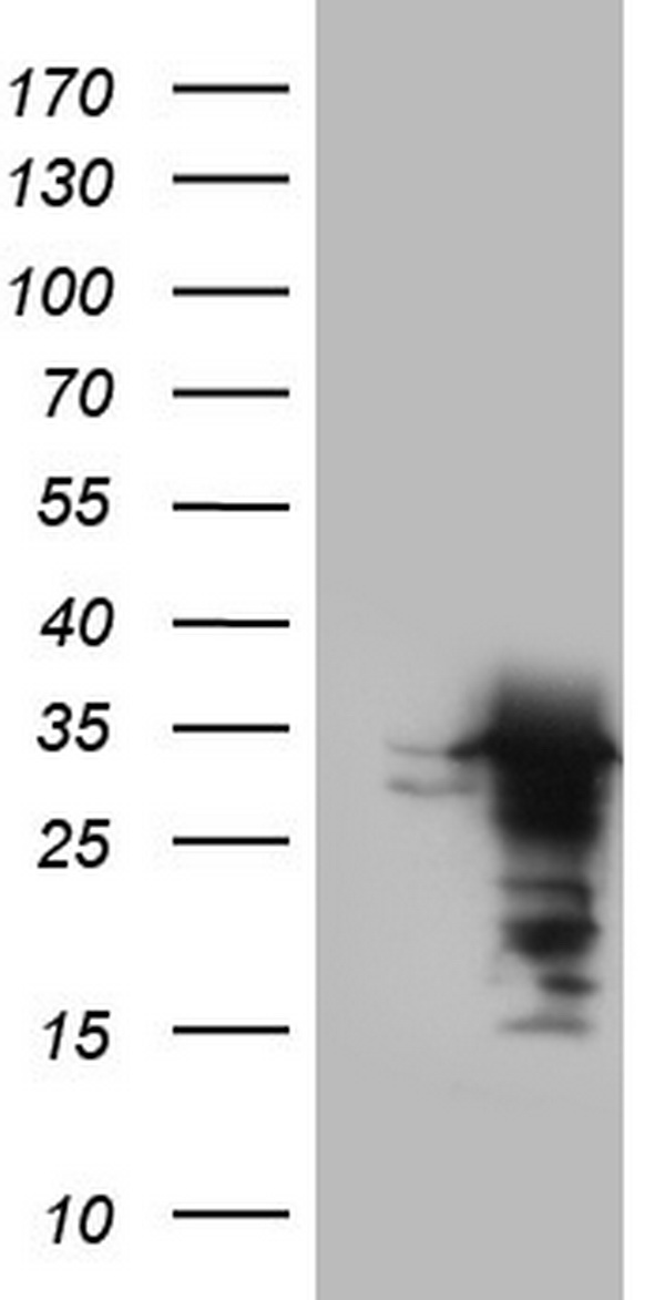 UFD1 Antibody