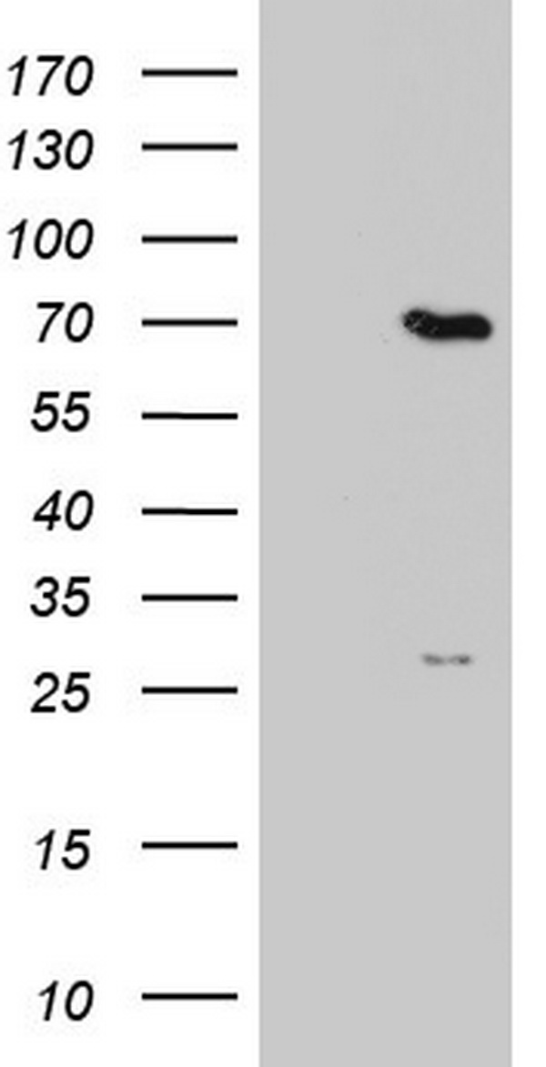 PPP2R5D Antibody