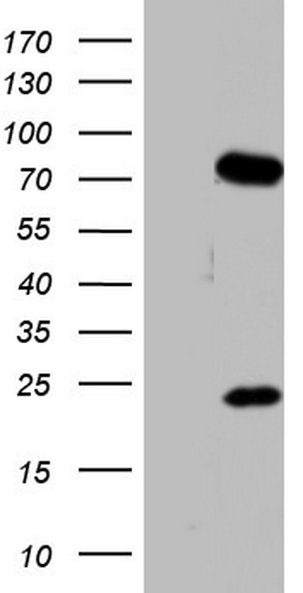 PPP2R5D Antibody
