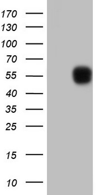 SETD2 Antibody