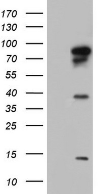 BFSP1 Antibody