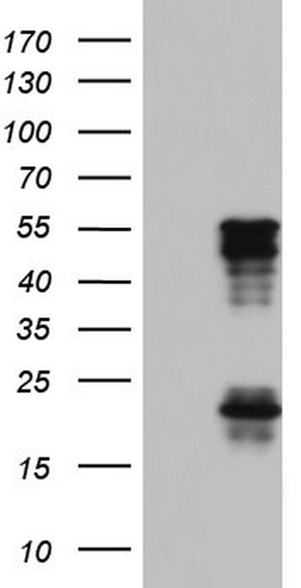 TET3 Antibody