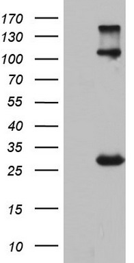 IGSF11 Antibody