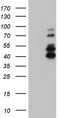 IRAK2 Antibody