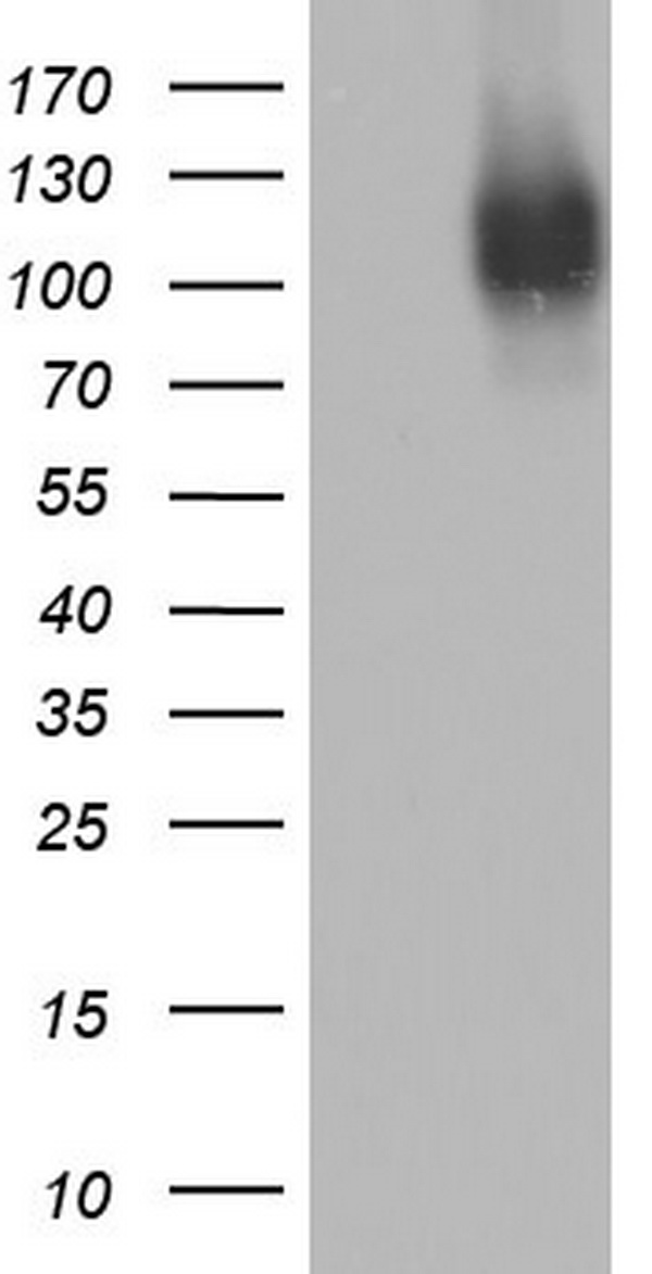 CD146 Antibody