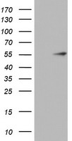 Cytokeratin 20 Antibody