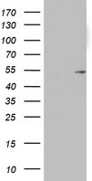 Cytokeratin 20 Antibody