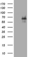 CD30 Antibody