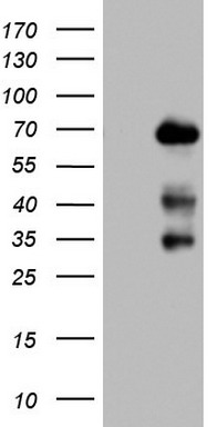 NUMB Antibody
