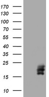 hCG beta Antibody