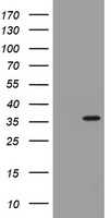 Thymidylate Synthase Antibody