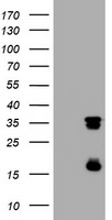 Thymidylate Synthase Antibody