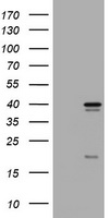Thymidylate Synthase Antibody