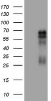 CD30 Antibody