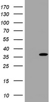Thymidylate Synthase Antibody
