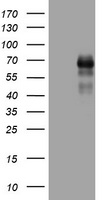 CD30 Antibody
