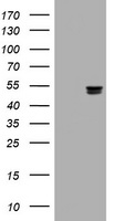 Thymidine Phosphorylase Antibody