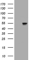 Thymidine Phosphorylase Antibody