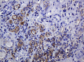 SOAT2 Antibody