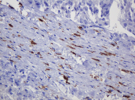 SOAT2 Antibody