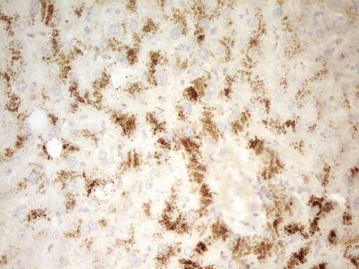 PIK3R4 Antibody