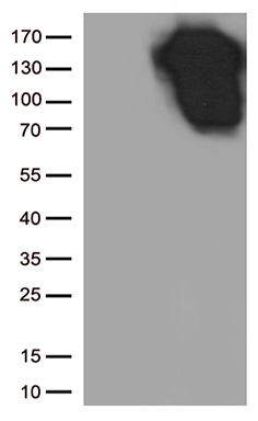E Cadherin Antibody