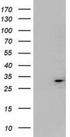 Mitocondrial Translational Initiation Factor 3 Antibody