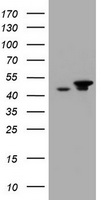 Epoxide hydrolase Antibody