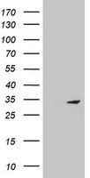 Mitocondrial Translational Initiation Factor 3 Antibody