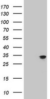 Mitocondrial Translational Initiation Factor 3 Antibody