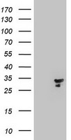 Mitocondrial Translational Initiation Factor 3 Antibody