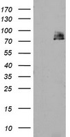 TPRKB Antibody