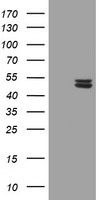 UQCRC1 Antibody