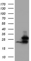 UBE2E3 Antibody