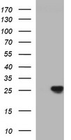 CHAC1 Antibody