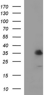 TXNDC Antibody