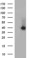 SERPINB3 Antibody