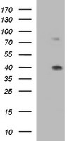 UPRT Antibody