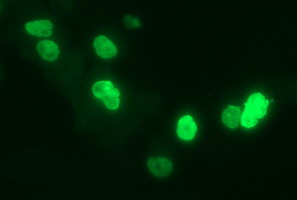 CHAF1B Antibody