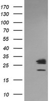 Galectin 3 Antibody