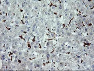 CD163 Antibody