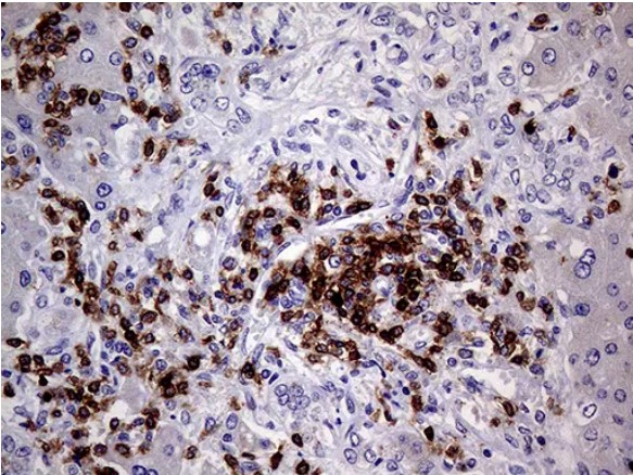CD3E Antibody