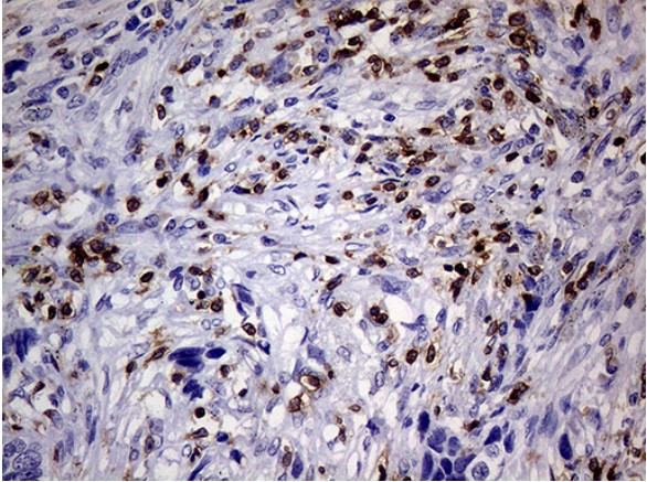 CD3E Antibody