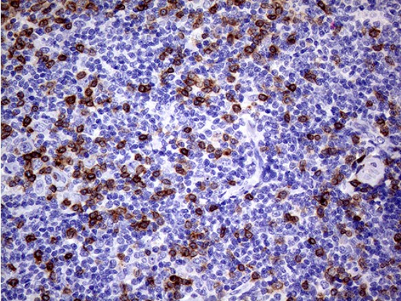 CD3E Antibody