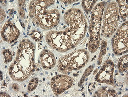 TRIM45 Antibody