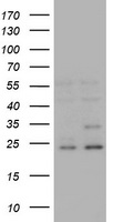 RAB21 Antibody