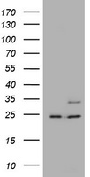 RAB21 Antibody